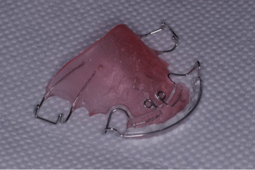 Upper removable appliance/plate